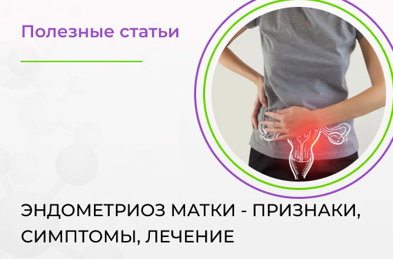 Эндометриоз матки - признаки, симптомы, лечение 
