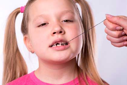 У ребенка шатается зуб: что делать если у ребенка шатается коренной или передний зуб