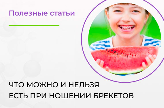 Что можно и нельзя есть при ношении брекетов