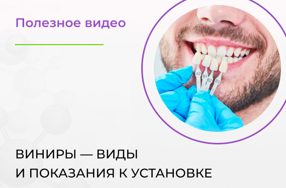 Виниры — виды и показания к установке