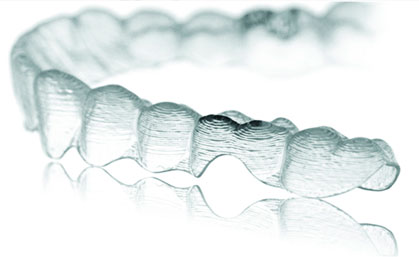 История ортодонтических брекетов