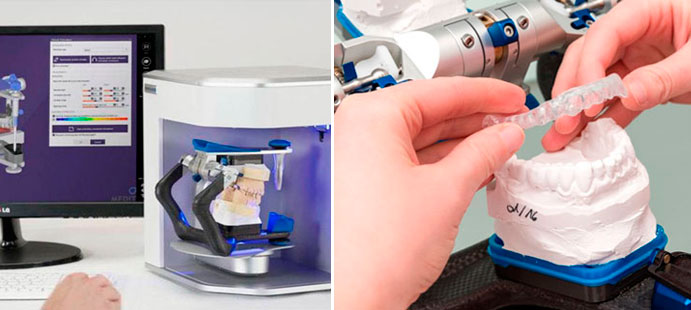 История ортодонтических брекетов