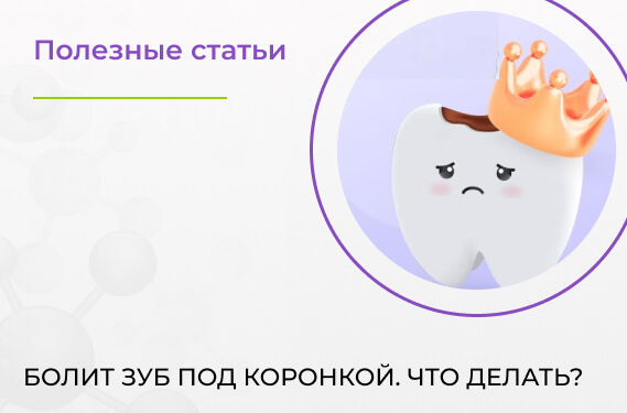  Болит зуб под коронкой. Что делать?