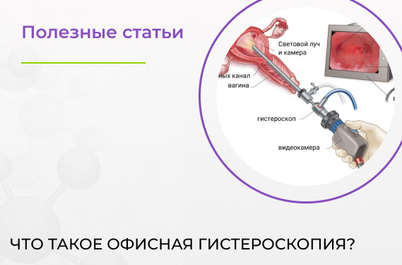Что такое офисная гистероскопия?