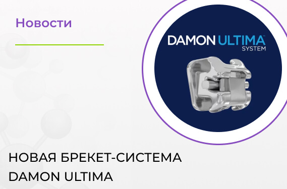 Преимущества новой брекет-система Damon Ultima