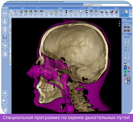 3D снимок носовых пазух и дыхательных путей