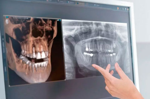 Diagnostics (3d image, X-ray)