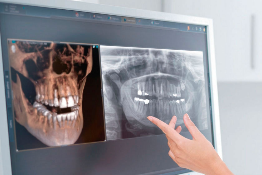 Diagnostics (3d image, X-ray)