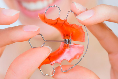 Пластинки для выравнивания зубов