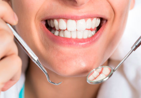 Dental restoration
